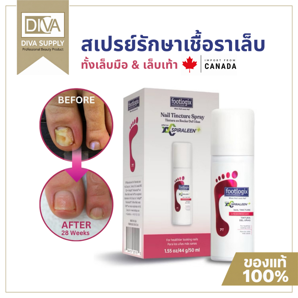 Footlogix #7T สเปรย์รักษาเชื้อราเล็บ ฆ่าเชื้อรา เล็บมือ เล็บเท้า ของแท้ นำเข้าแคนาดา 50ml