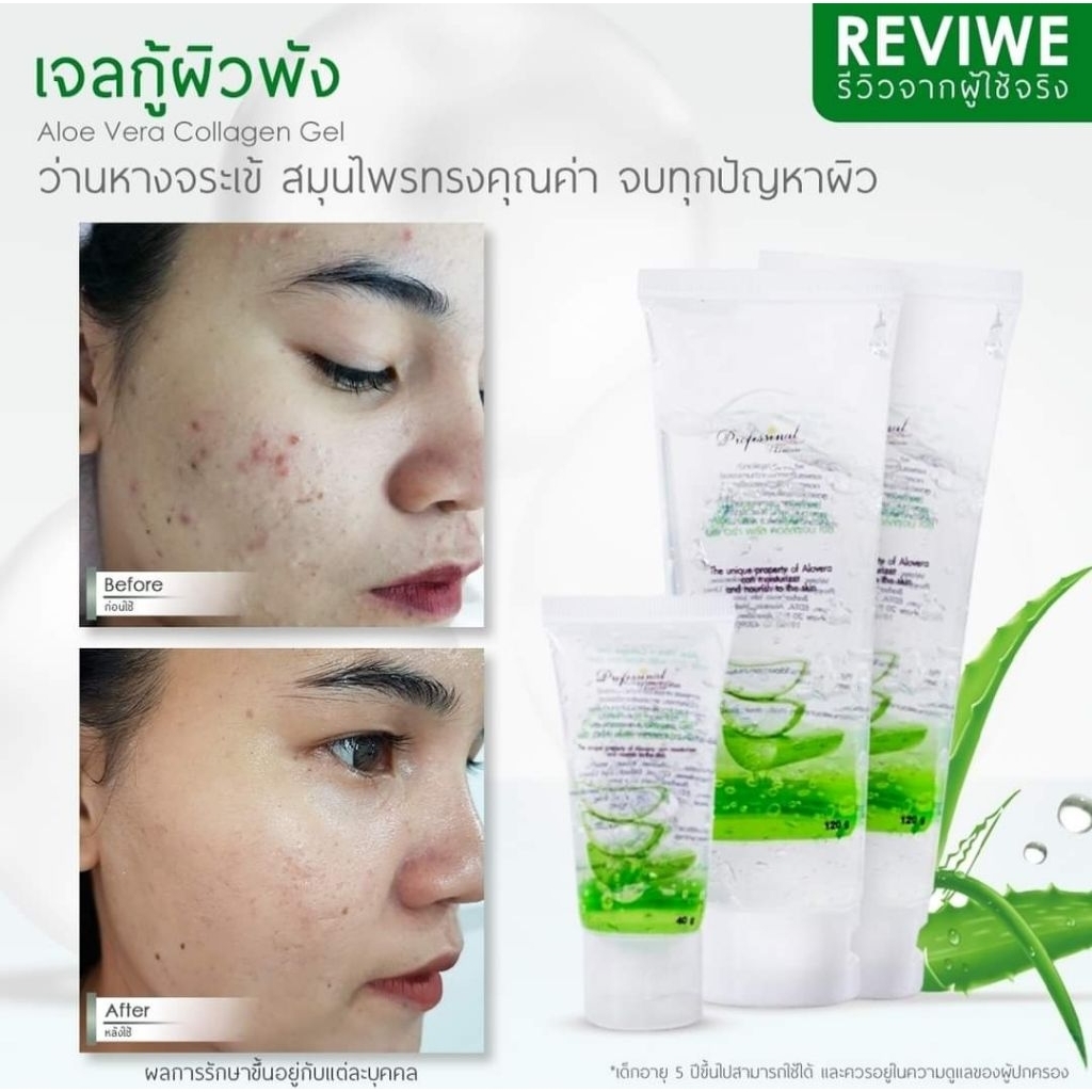 เจลว่านหางจระเข้อโลเวล่าคอลลาเจน