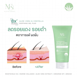 ส่งทันที : ลด 10% ในไลฟ์ ♡ มอยเจอร์ คามมิ่งเจล อโลเวร่าพลัส เปลี่ยนชื่อใหม่ ALOE VERA PLUS พี่กุ้งกดสิว มาดามกิ๊กกี้
