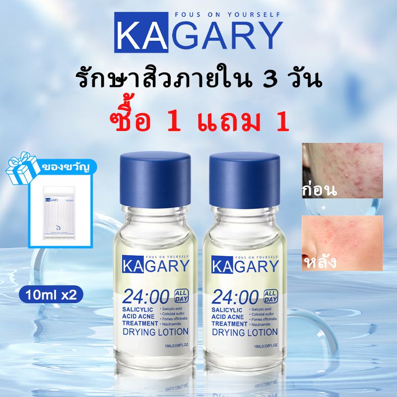 Kagary เซรั่มลดสิว จัดการสิวอักเสบ 1 แถม 1 Salicylic Acid Serum Anti Acne Lotion 10ml*2