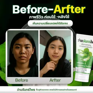 จันทร์ไพร ลดรอยแตกลาย แผลเป็น ด้วยสมุนนไพรธรรมชาติเข้มข้น