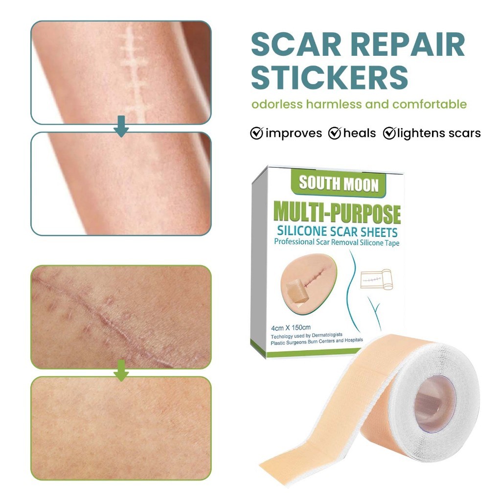 South Moon แผ่นแผลเป็นซิลิโคน Silicone Scar Sheet 4*150cm ลดรอยแผลเป็น การกำจัดรอยแผลเป็น แผลคีลอยด์