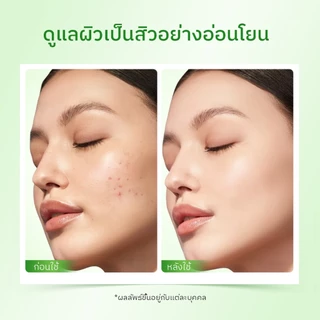 【เซ็ตคู่】The originote มาส์กโคลนแบบแท่งจิงจูฉ่าย Mugwort B3 Clay stick mask พิเศษ 2 ชิ้น