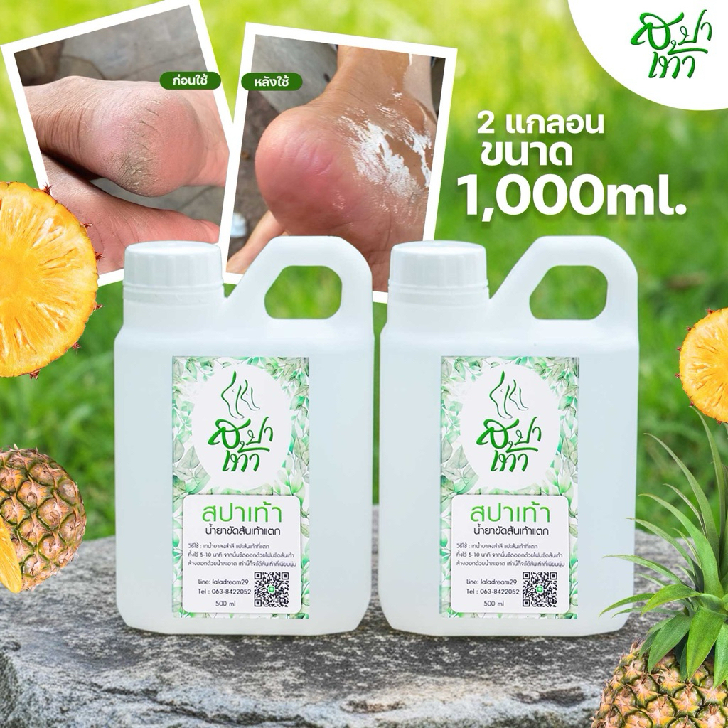น้ำยาขัดส้นแตก 1000 ml แถม โฟมขัดส้นเท้า  ช่วยให้ส้นเท้ากลับมาเนียนนุ่ม ไม่แตกลาย