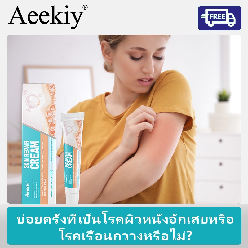 Aeekiy ครีมบำรุงผิวอีคซีมา บรรเทาอาการคันผิวหนัง ลดการแพ้ผิวหนังอย่างอ่อนโยน ช่วยปลอบประโลมและเพิ่มความชุ่มชื้น