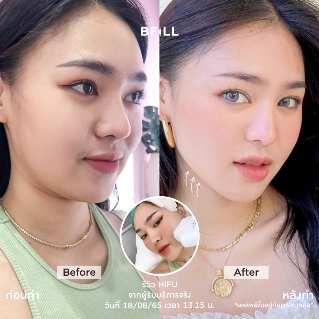 รูปภาพ 5