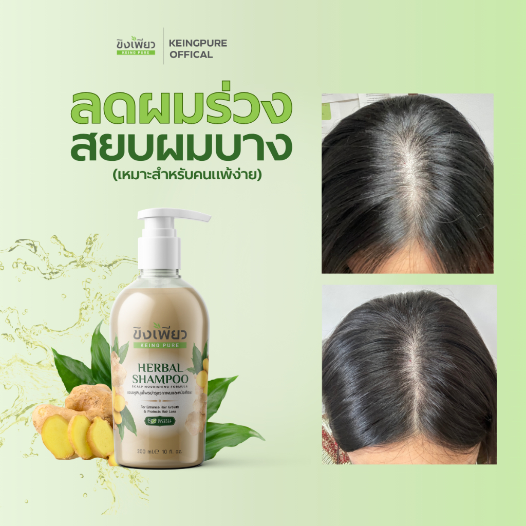 ขิงเพียวแชมพูสมุนไพรสูตรลดผมร่วงขนาด 300มล. (MADE IN THAILAND)