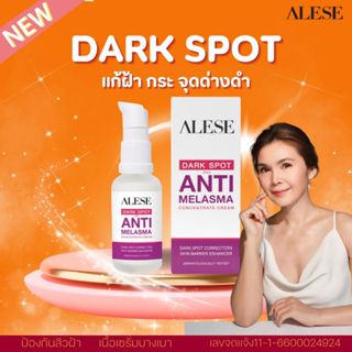 (โปรสงกรานต์ 4.4.)ALESE Dark Spot And Melasma Concentrate Cr…