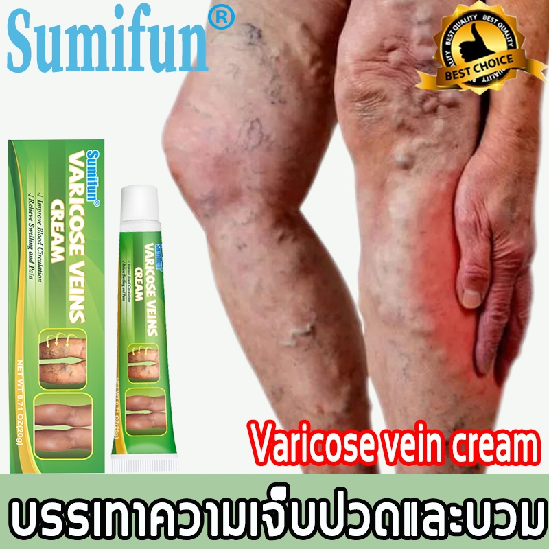 ☘️ซื้อ 2 แถม 1☘️ ครีมทาเส้นเลือดขอด ส่งเสริมการไหลเวียนของเลือด รักษาขาให้สวย ครีมสำหรับทาขา ขนาด 20 กรัม