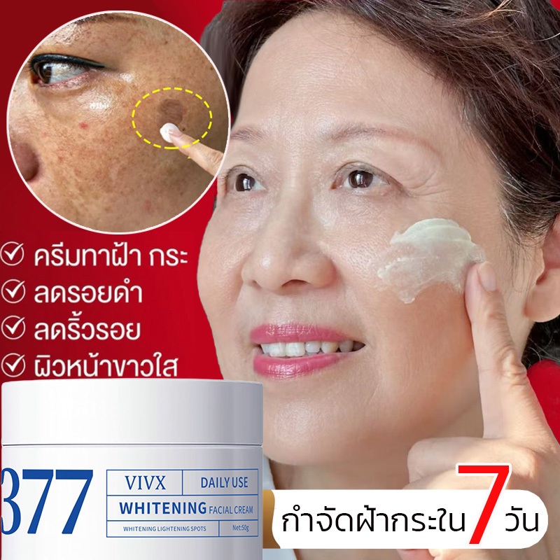 สินค้าขายดี 377 ครีมแก้ฝ้าผิวขาว อุดมไปด้วยไนอาซินาไมด์ ไวท์เทนนิ่ง ครีมแก้ฝ้า ครีมแก้ฝ้าไวท์เทนนิ่งผิว