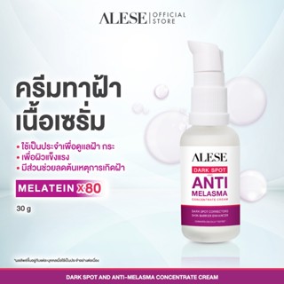 ✨ ราคาพิเศษ 11–15 เท่านั้น ✨ALESE อะลิเซ่ ครีมทาฝ้า ลดจุดด่า…