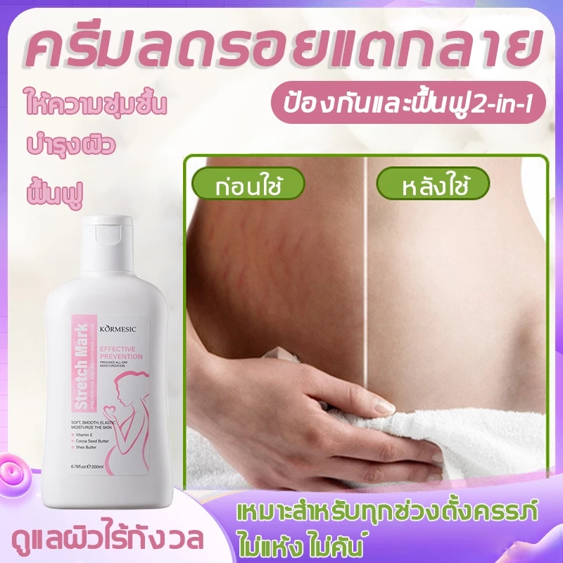 【ลดรอยแตกลายภายใน 7 วัน】ครีมรอยแตกลาย สเปรย์ลดรอยแตกลาย รอยแตกลาย สำหรับการซ่อมแซมผิวหลังคลอด strech mar