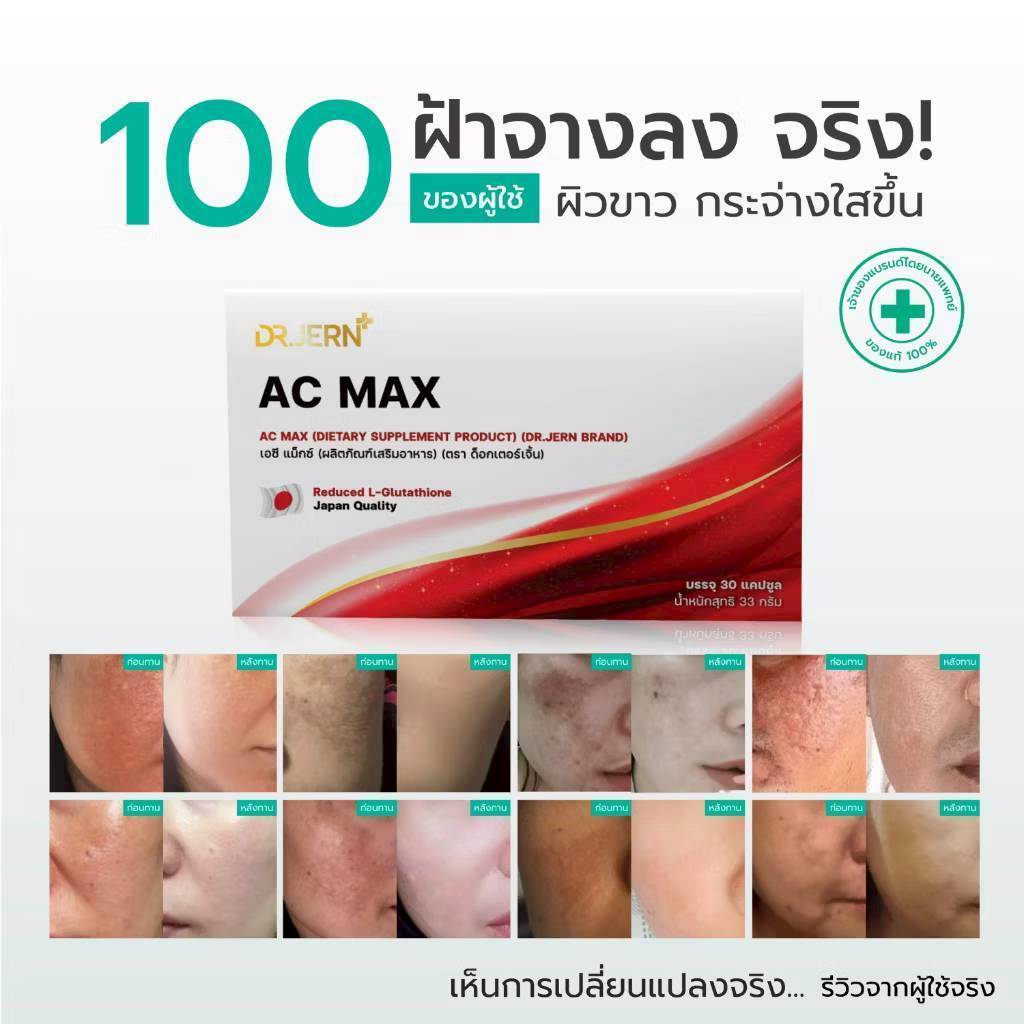 เอซีแม็กซ์ AC MAX วิตามินดูแลผิว รักษาฝ้า กระ ปรับผิวขาว แบรนด์หมอเจิ้น กล่องละ 30 แคปซูล ราคา ถูกที่สุด ดีลบีเคเค แกลเลอรีภาพที่ 3