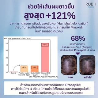 Rubii Intensive Hair Serum เซรั่มลดผมร่วง ดูเเลผมบาง บำรุงรากผม 4-in-1