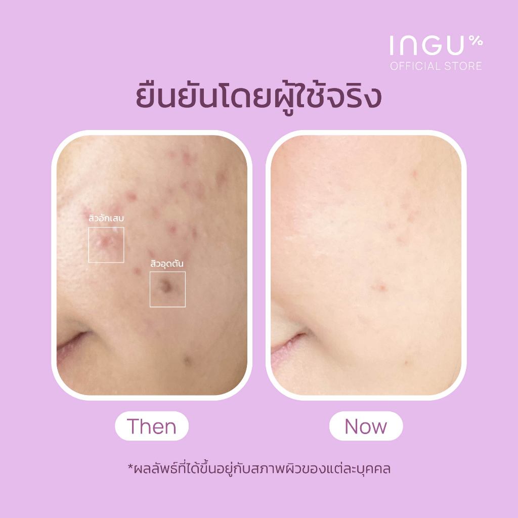 รูปภาพ 6