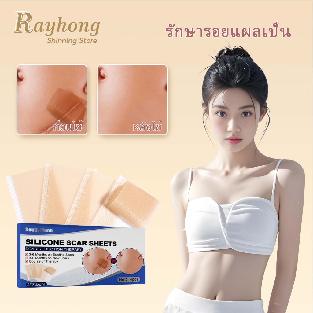 South Moon แผ่นแปะแผลเป็น เทปซิลิโคนปิดแผลเป็นกําจัดรอยแผลเป็นจากแผลเป็นเผยผิวเนียนสวยสูตรผิวแพ้ง่าย