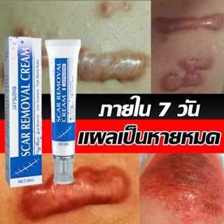 ลบรอยแผลเป็นสีดำ ลดรอยแผลใหม่และเก่า ฟื้นฟูผิวให้เรียบเนียน …