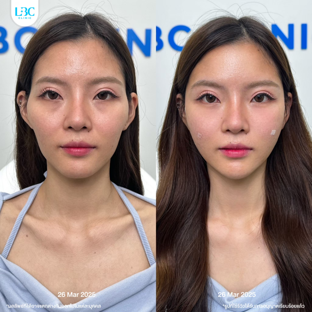 รูปภาพ 3