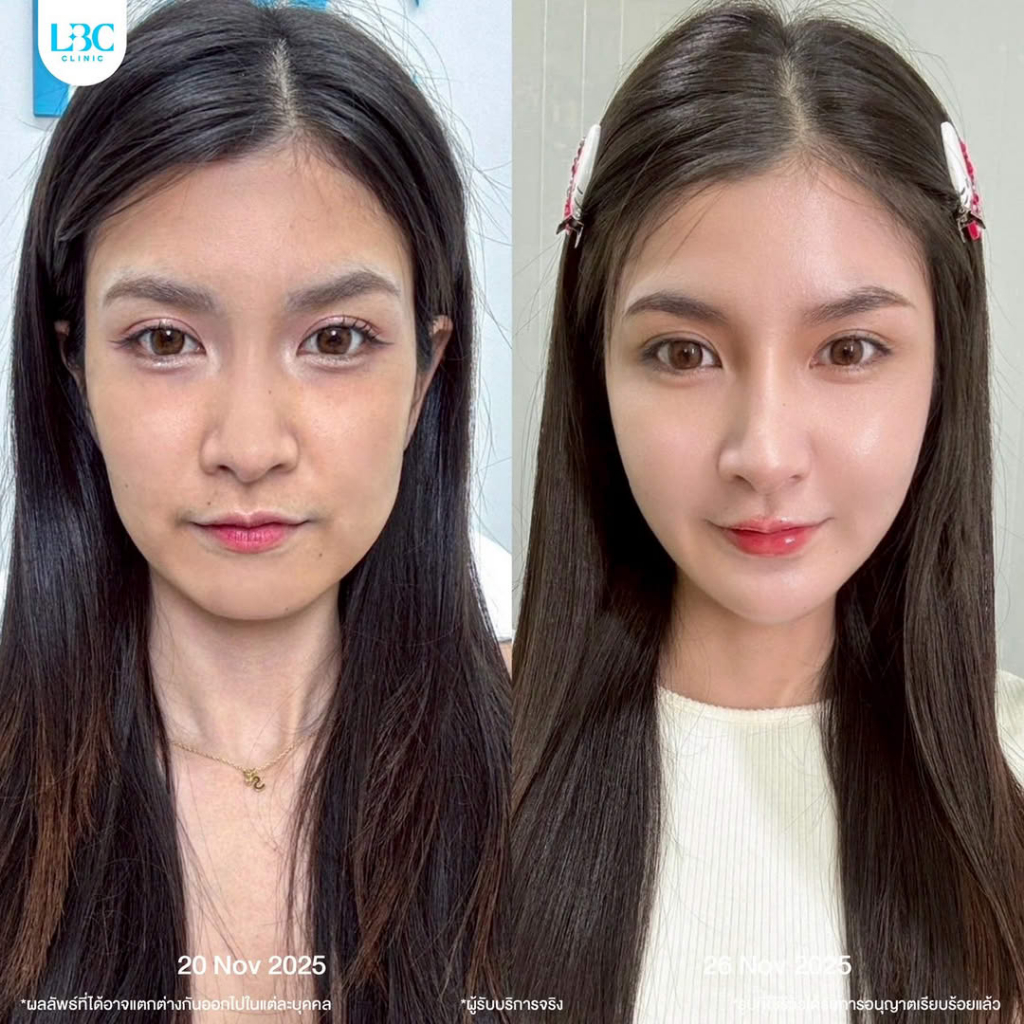 รูปภาพ 4