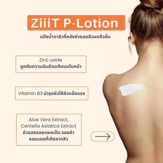 ( 1แถม 1) Ziiit P-Lotion 50g แป้งน้ำทาสิวผด สิวผื่น ทั้งใบหน้าและแผ่นหลัง ช่วยยับยั้งแบคทีเรีย