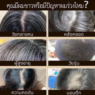 SAFEMILD แชมพูสมุนไพรผมดำ 300มล. เปลี่ยนผมขาวให้เป็นสีดำอย่างเป็นธรรมชาติ และปกปิดผมหงอกได้อย่างมีประสิทธิภาพ