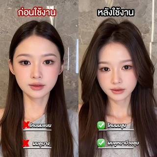 Volumix Root Lift Clip กิ๊บใบพัดหนีบยกโคนผม ดีไซน์ใบพัด 4 แฉก เกาะผมแน่น ไม่ลื่น กิ๊บเพิ่มวอลลุ่มผม ยกโคนผมให้พองทันที