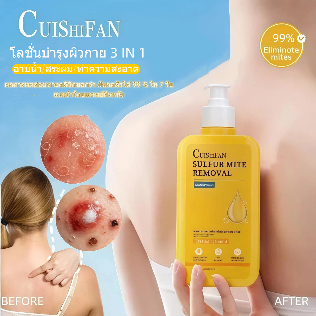 เจลอาบน้ำ 3 ใน 1 (อาบน้ำ/ล้างหน้า/ล้างผม) เจลอาบน้ำหอม รักษาสิวหลัง หมักศีรษะ และอาการคัน ขจัดฝ้า ให้ผิวขาวกระจ่างใส