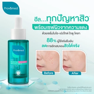 PROVAMED BIO-PEPTIDE GOTU KOLA ANTI ACNE SERUM 30 ML