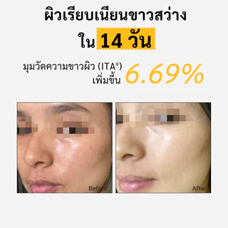 Spring Letter Toner Pad แผ่นเช็ดหน้า VC ลดจุดด่างดำ ขาวใส ละลายฝ้า จุดด่างดำ กระ ฝ้า จุดด่างดำ จางลง สำหรับผิวบอบบาง