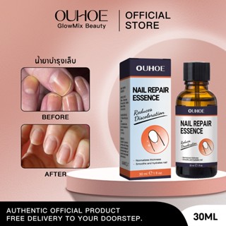 OUHOE เซรั่มเล็บ เซรั่มบำรุงเล็บ บำรุงเล็บ ทำให้เล็บสวย ซ่อม…