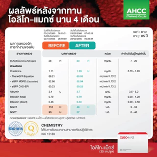 SAMA LAB+ OLIGO MAX โอลิโกนอลสารสกัดจาก โอลิโกนอล โปรแอนโธไซยานิดิน โอลิโกเมอร์