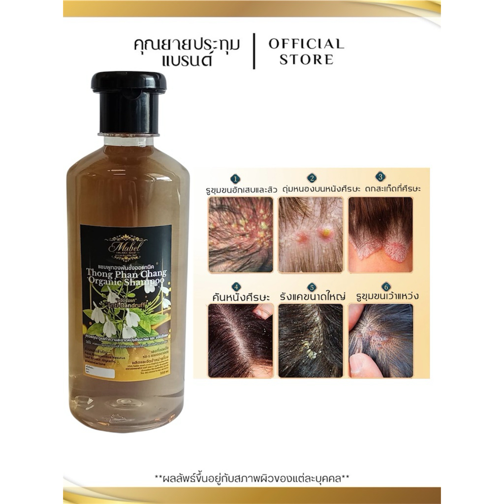 แชมพูทองพันชั่งOrganic 1 แถม 1 ขวด ขจัดรังแคเรื้อรัง คันหนังศรีษะ เชื้อรา กลากเกลื้อน