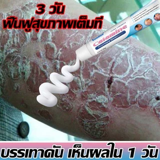 การฟื้นฟูอย่างมืออาชีพ ทาแก้เชื้อรา โรคผิวหนัง เกลื้อน กลาก คัน สมุนไพร แก้คันเรื้อรัง คันในร่มผ้า คันในร่มผ้า ครีมแก้ค