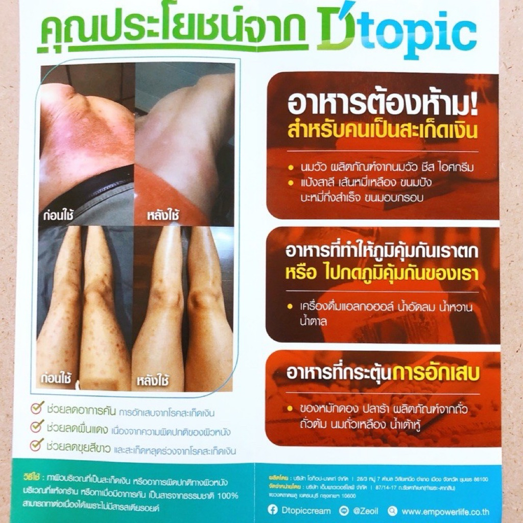 Thai-bio skin care cream 50 g. โฉมใหม่ของ Dtopic cream สะเก็ดเงิน และโรคผิวหนัง แพ้ คันไม่มีสเตียรอยด์ สารสกัดจากสมุนไพร - รูปที่ 3