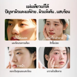 Spring Letter Toner Pad แผ่นมาส์กเซนเทลล่า ปลอบประโลมผิว ลดรอยแดง บำรุงผิวแพ้ง่าย ปลอบประโลมอย่างเร่งด่วน บำรุงผิว