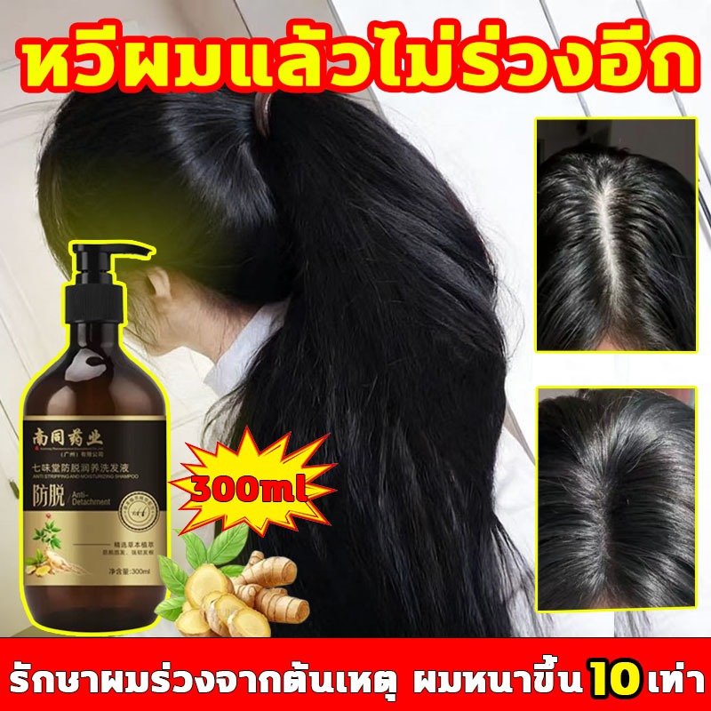 แชมพูป้องกันผมร่วง หวีผมแล้วไม่ร่วงอีก แชมพูปลูกผม รักษาผมร่วงจากต้นเหตุ ผมหนาขึ้น 10 เท่า  แชมพูผมดํา – โปรปัง