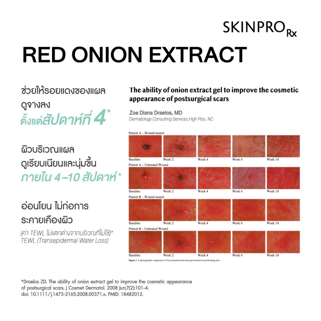 SKINPRO Rx Acne X Spot Repair 5ml ครีมลดปัญหารอยแผลจากสิว รอยแดง รอยดำ รอยแผล ลดการเกิดสิวซ้ำ thumbnail 4