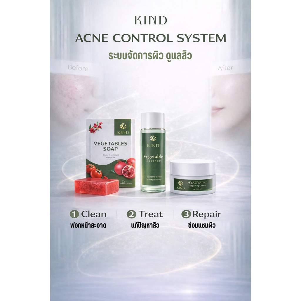 KIND Acne Treatment คู่ลดสิว แถมสบู่ Vegetables