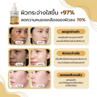 POPASKIN 577+377 Radiance Glow Serum เซรั่มผิวขาว ลดรอยสิว ผิวกระจ่างใส ฉ่ำโกลว์ ลดผิวหมองคล้ำ ลดจุดด่างดำ ผิวกระจก 30ML