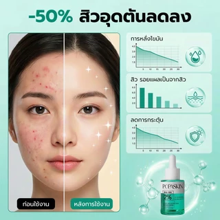 POPASKIN 2% BHA+MA Anti-Acne Serum เซรั่มลดสิว ลดรอยสิว คุมมัน ลดสิวอุดตัน ลดการอักเส 30ML