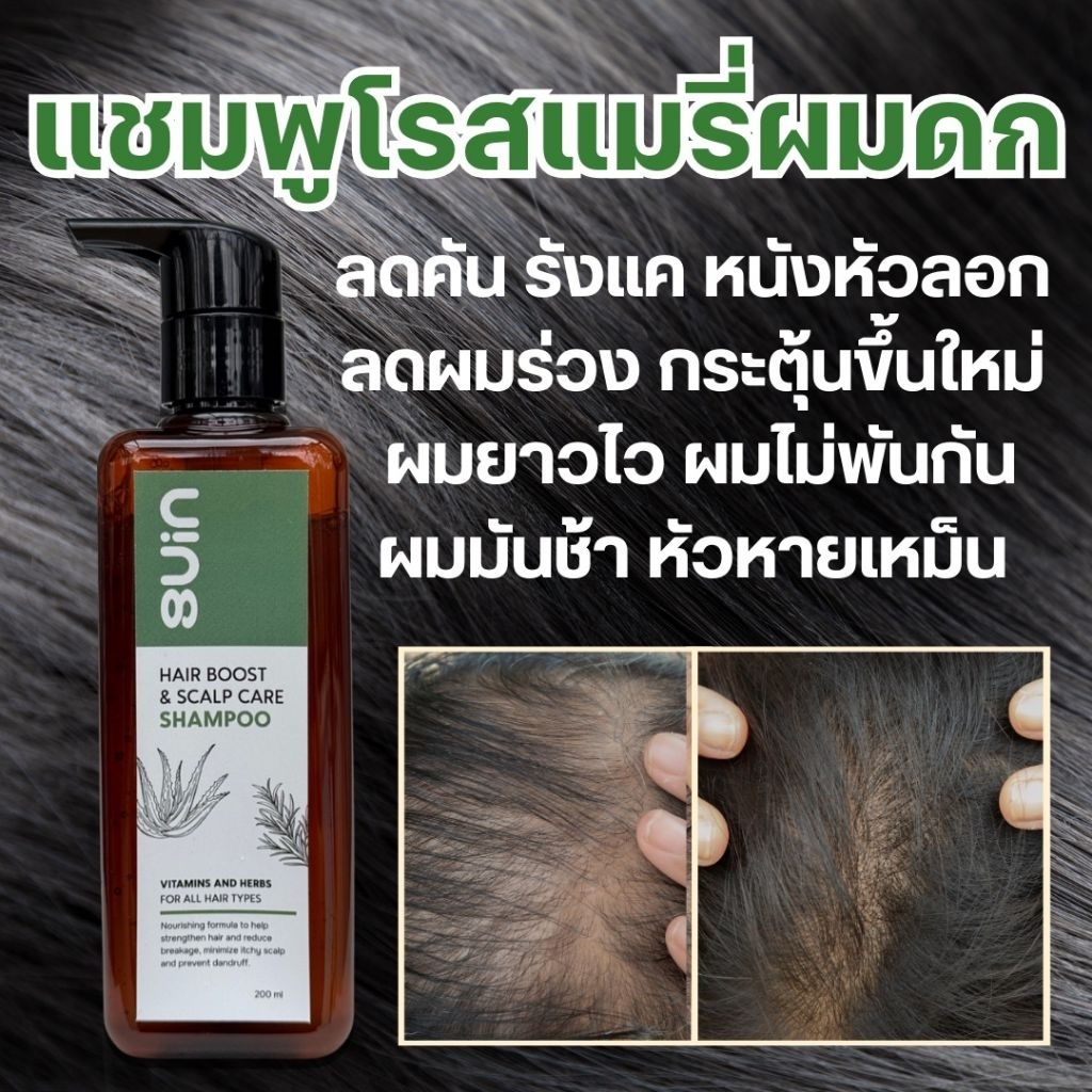 แชมพูโรแมรี่ ผมดก ยาวไว ลดคัน รังแค เห็นผลจริง! ลดผมร่วง ผมเกิดใหม่ ยาวไว ผมลื่นไม่พันกัน