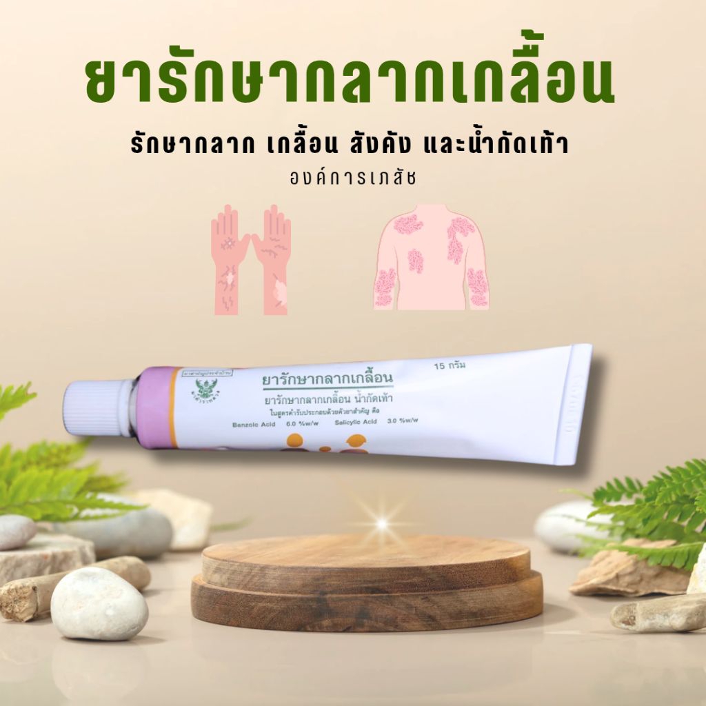 ยารักษากลากเกลื้อน น้ำกัดเท้า สังคัง ยาสามัญประจำบ้าน โดยองค์การเภสัชกรรม GPO