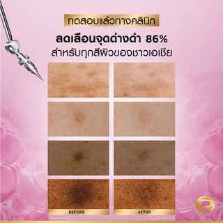 [ใช้โค้ดไลฟ์เหลือ 724.-][แพ็กคู่] L'Oréal Paris Glycolic Bright Anti-Dark Spot Brightening Serum 30ml x2 เซรั่มผิวโกลว์