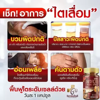 MYCO Prime Plus (1แถม1) ผลิตภัณฑ์เสริมอาหาร วิตามินบำรุงไต ดูแลสุขภาพไต เสริมการทำงานของไต