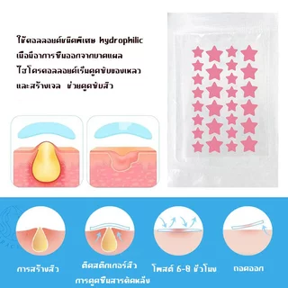 แผ่นแปะสิว แผ่นแปะรักษาสิว แผ่นสิว แผ่นแปะดูดสิว แผ่นดูดสิว แผ่นสติกเกอร์แปะสิว Acne Patches รูปดาวน่ารัก หลากสีสัน 3 สี