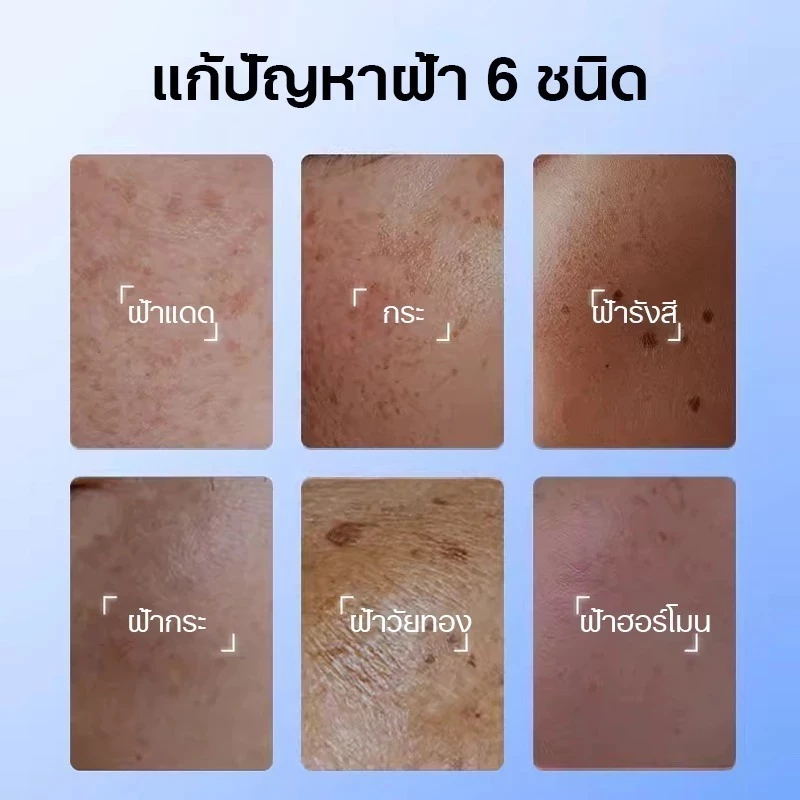 377ครีมบํารุงผิวผิวให้กระจ่างใสของผิวและปรับผิวให้กระจ่างใส ด้วยเติมความชุ่มชื้นแก่ผิวสกินแคร์ thumbnail 4
