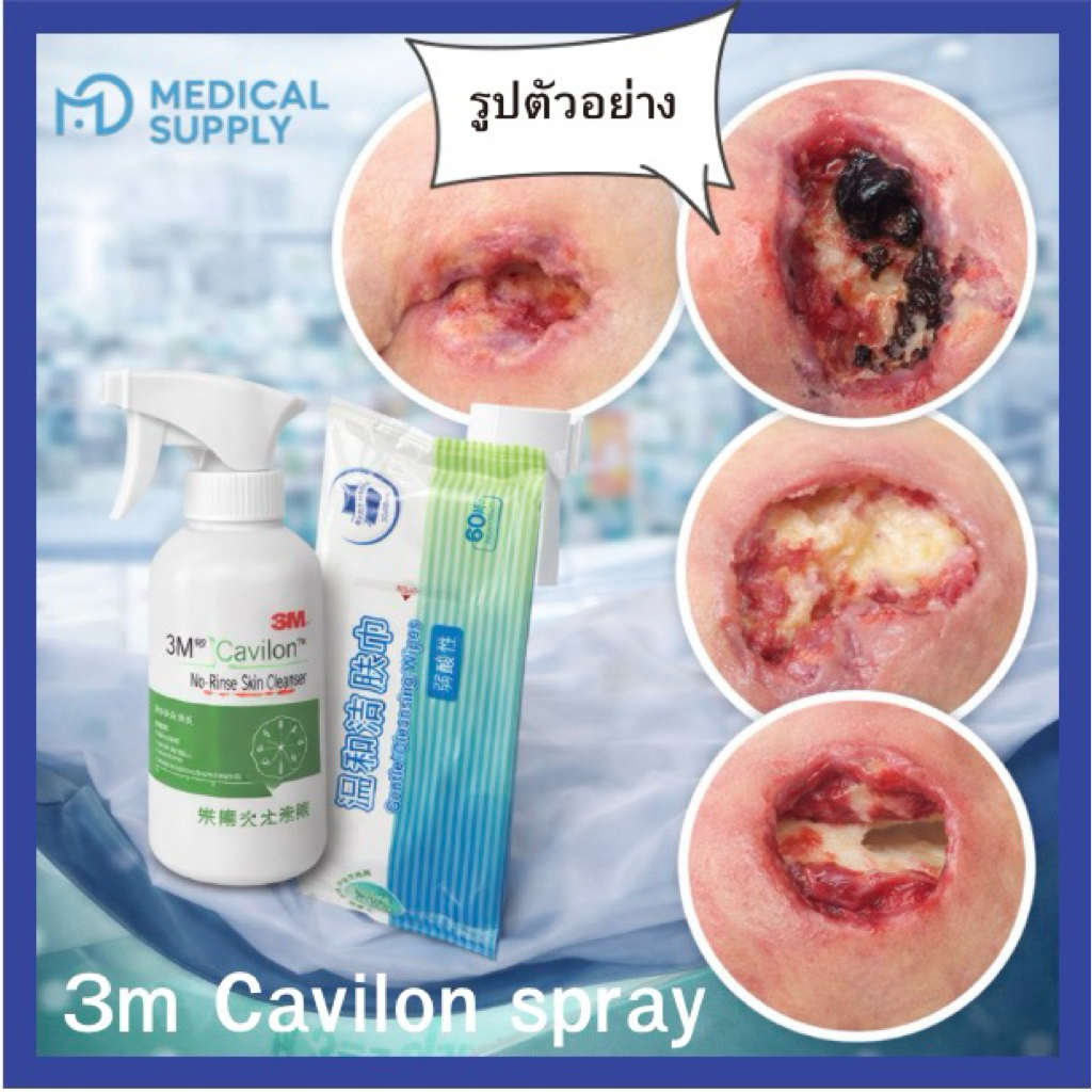 3m Cavilon spray (1  กล่อง )แถม ฟรีพิเศษผ้าเช็ดทำความสะอาด 60 แผ่น