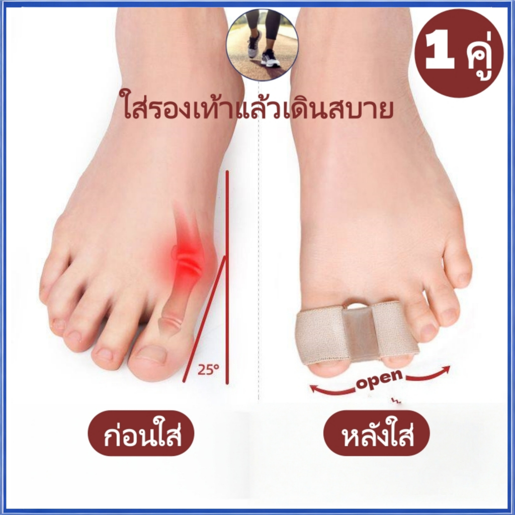 ที่แยกนิ้วโป้งเท้าแบบผ้านุ่ม ลดการเกเอียง ป้องกันนิ้วเบียด–นิ้วซ้อนเสียดสี บรรเทาอาการปวดเท้าได้