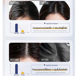 Dr.eyemo แชมพูขจัดรังแค Shampoo 500Ml ป้องกันการกลับมาเป็นซ้ำ 3in1 ทำความสะอาด ชุ่มชื้น กำจัดรังแค
