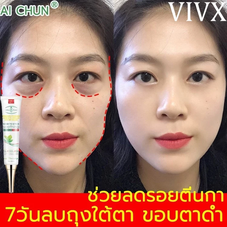 VIVX เม็ดไขมัน 30ml ลบคล้ำบวมใต้ตา กระชับรอยตีนกา ลดเม็ดไขมัน ฟื้นฟูผิวตา ครีมทารอบดวงตา เซรั่มอายครีม อายครีม